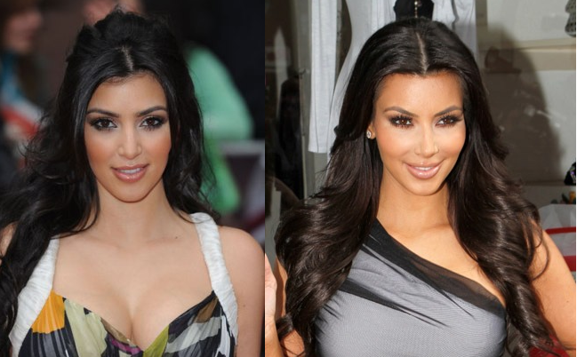 Kardashian now exhibits tale tale signs of plastic surgery with the overly